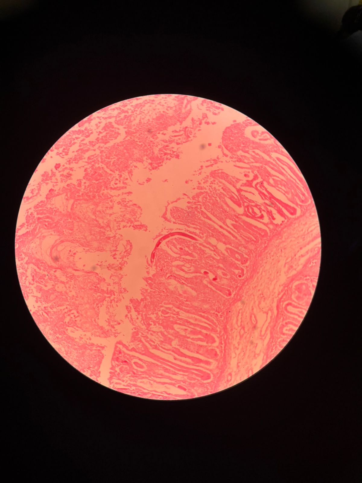 term image