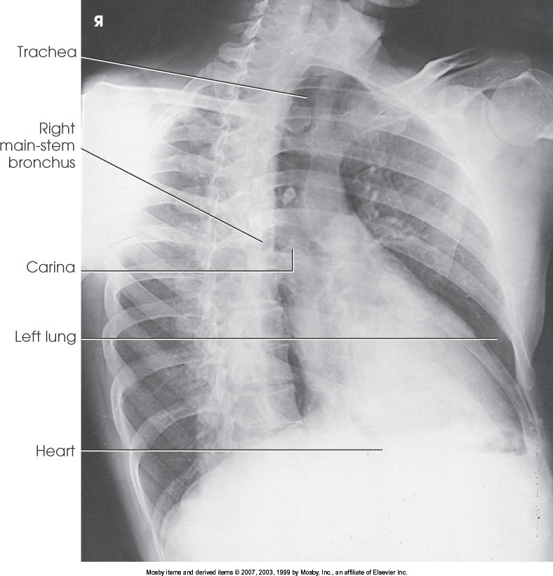 <p>What position is demonstrated?</p>