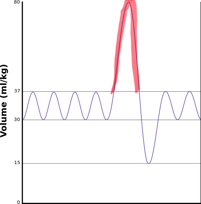 <p>Maximum amount of air you can forcibly inhale after tidal volume, typically 3000 mL</p>