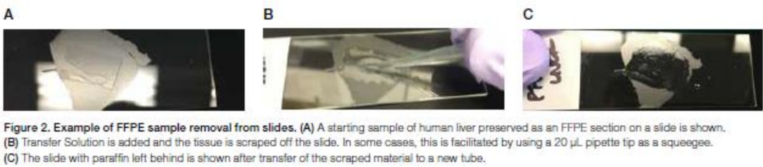 <p>FFPE DNA (Ion AmpliSeq)</p><p>1.	Using a 20uL pipette tip, add 10uL of transfer solution onto region of interest of the slide-mounted FFPE tissue section</p><p>2.	Spread transfer solution, then scrape and break up the tissue with pipette tip. The tissue is a slurry of fine particles</p><p>3.	Pipet the slurry from the slide into a 0.2ml tube</p><p>4.	Add direct reagent and mix. Incubate 65 degrees for 15 min then 95 degrees for 10 min</p><p>5.	Centrifuge briefly. The bottom phase contains extracted DNA and can be used for sequencing</p><p></p>