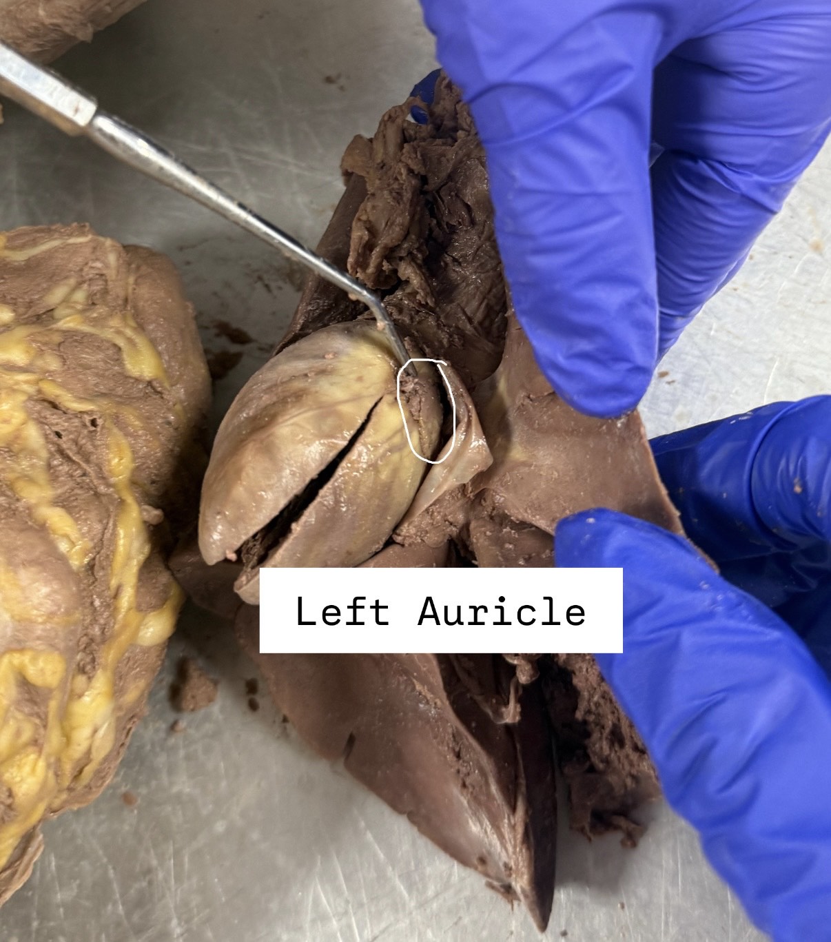 <p>Left Auricle</p>