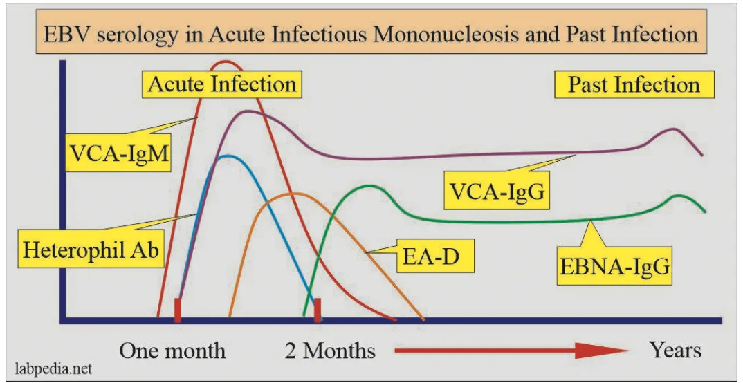 <p>EBV specific Ab testt</p><p>a. immunofluorescent assays for IgM &amp; G anti-viral capsid Ag</p><ul><li><p>anti-VCA - IgM or G</p></li><li><p>anti-EA </p></li><li><p>anti-EBNA</p></li></ul><p>current/recent infn = </p><ul><li><p>IgM anti-VCA; </p></li><li><p>anti-EA; </p></li><li><p>IgG anti-VCA w/o anti-EBNA</p></li></ul><p></p><p>past infn  = anti-EBNA or IgG anti-VCA w/o IgM anit-VCA</p>