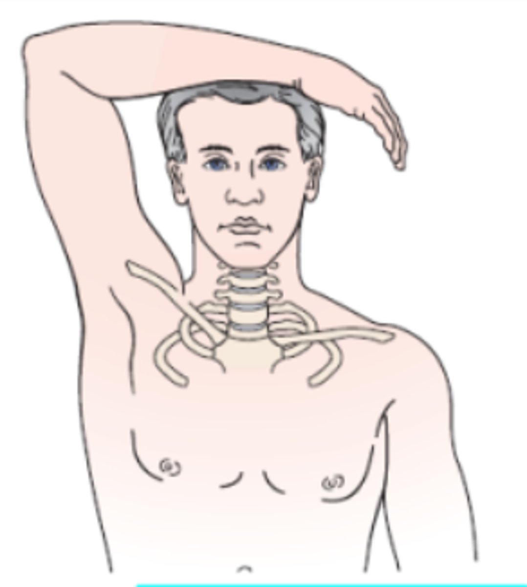 <p>- radicular symptoms (C4/ C5)</p><p>(+): A decrease in or relief of symptoms indicates a cervical extradural compression problem, such as a herniated disc, epidural vein compression, or nerve root compression, usually in the C4-C5 or C5-C6 area.</p>
