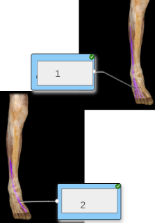 <p>name muscles 1-2</p>