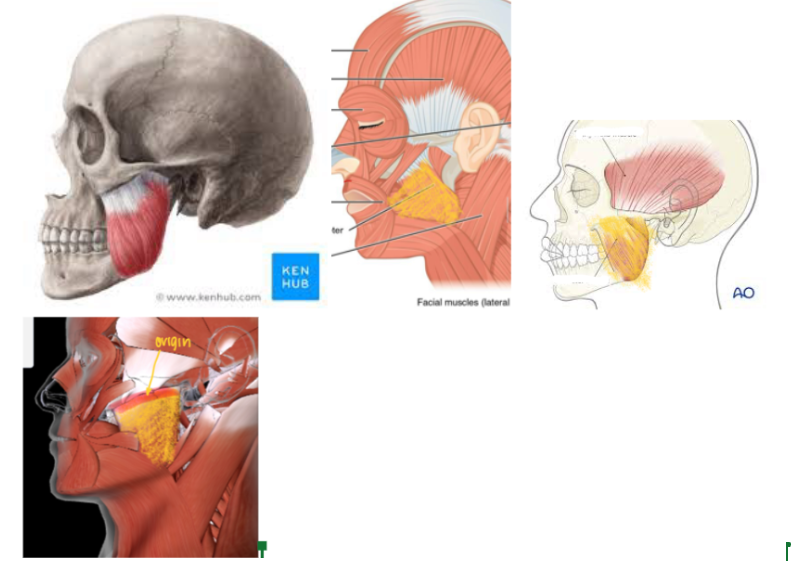 <p>Function: Responsible for<strong> CHEWING (ELEVATE MANDIBLE AT THE JAW)</strong></p><ul><li><p><strong>Origin</strong>: Zygomatic Bone</p><ul><li><p>This is part of the muscle that just ATTACHES to the bone WITHOUT MOVEMENT</p></li></ul></li><li><p><strong>Insertion</strong>: Mandibular ramus and angle</p><ul><li><p>This is the part of the muscle that MOVES when there’s a contraction</p></li></ul></li></ul><p></p>