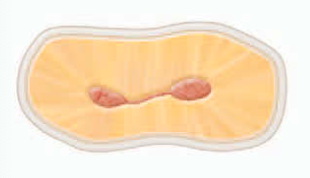 <p>an incomplete isthmus</p><p><span><strong><span>it is a faint communication between two canals.</span></strong></span></p>