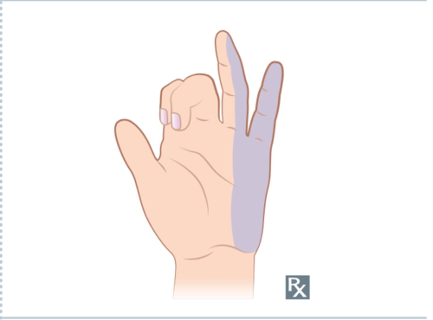 <p>Claw Hand</p>