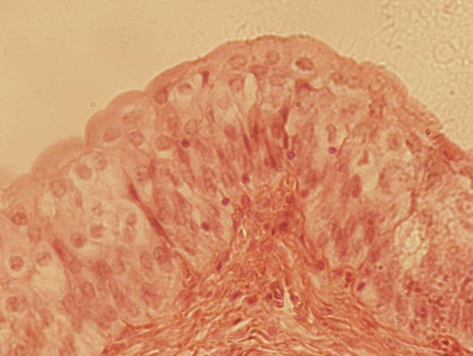 <p>transitional epithelial tissue</p>