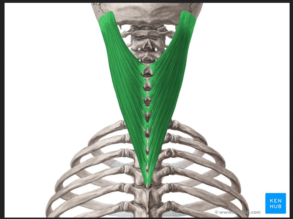 <p>Muscle of the face, head and, neck:</p><p>Spenius capitus</p>