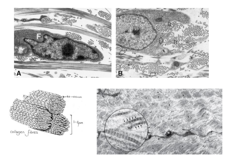 <p>fibroblasts with fibrocytes </p>