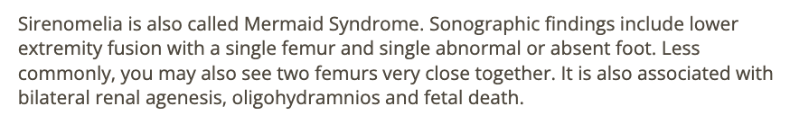 <p>b) sirenomelia</p>