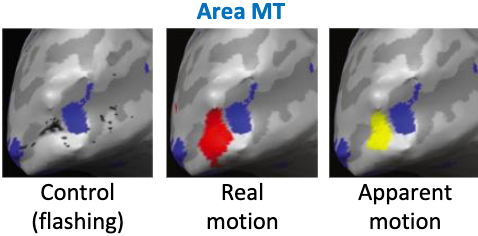 <p>A brain region associated with motion perception</p><p>= Direction and speed of object motion</p><ul><li><p><span style="color: red">Control Condition:</span> No significant brain response observed.</p></li><li><p><span style="color: red">Real Motion Condition</span>: Strong response detected in area MT.</p></li><li><p><span style="color: red">Apparent Motion Condition</span>: Reasonably strong response, no significant difference from real motion response.</p></li></ul><p></p>