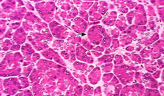 <p>-Acinar cells: (exocrine) produce digestive enzymes, found outside of islets</p>