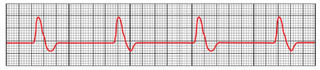 <p>What rhythm is this called?</p>