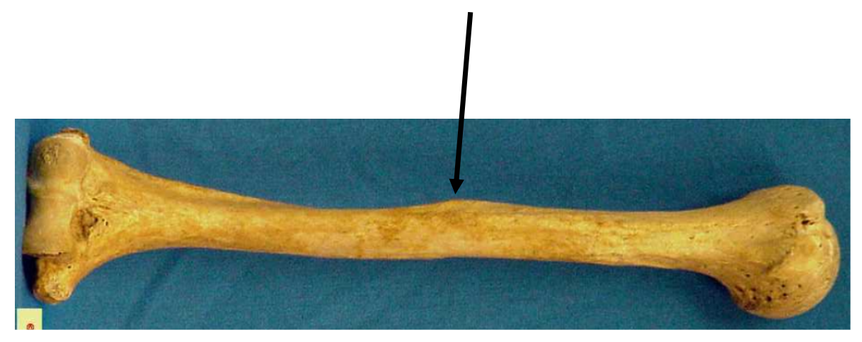 <p>The photo provided shows a humerus. The arrow is pointing to</p><p></p><p>A. radial groove</p><p>B. lesser tubercle</p><p>C. deltoid tuberosity</p><p>D. capitulum</p>