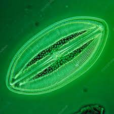 <p>What type of view of the diatom is this?</p>