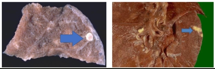 <p>Identify and What are the components of it?</p><p>+Arrows point to what?</p>