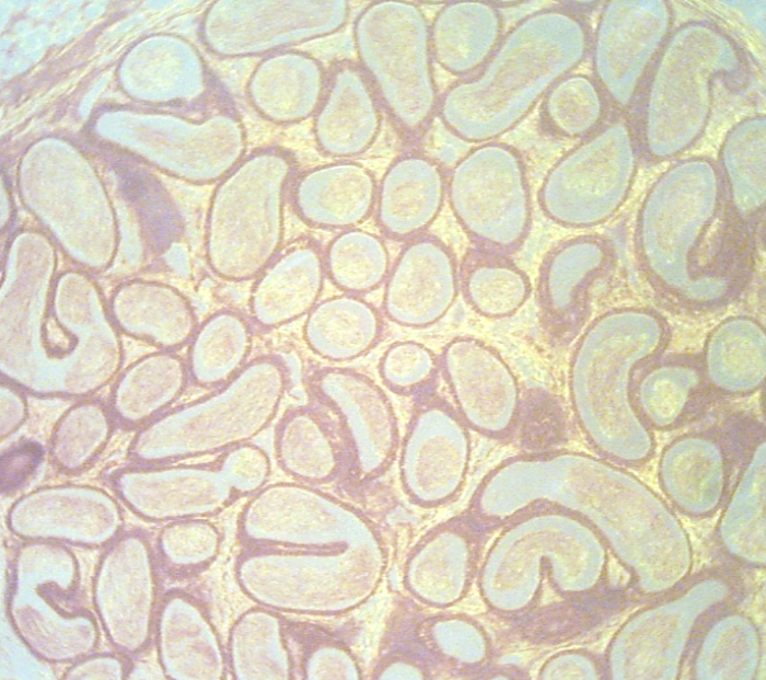 <p>What is the organ being depicted in the micrograph?</p><p>*Hint: This organ is responsible for sperm maturation and extragonadal storage.</p>