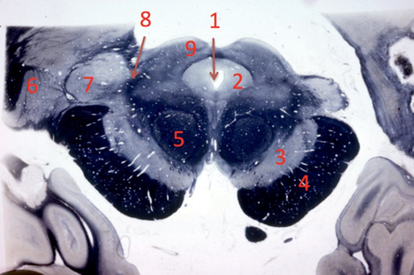 <p>lateral geniculate</p>