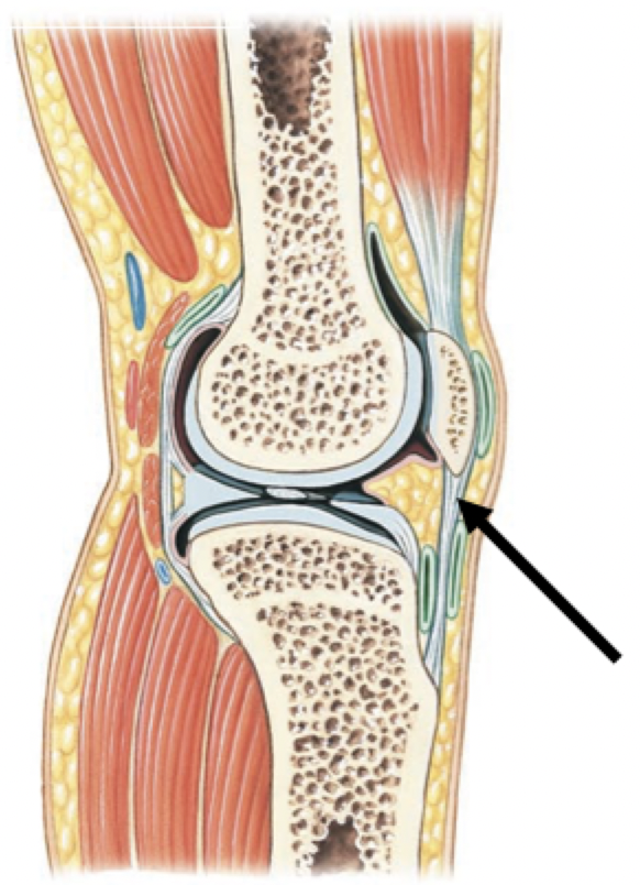 <p><strong>Ligaments</strong></p><ul><li><p>Fibrous connective tissue connecting bone to bone</p></li><li><p>Support and strengthen synovial joints</p></li></ul>