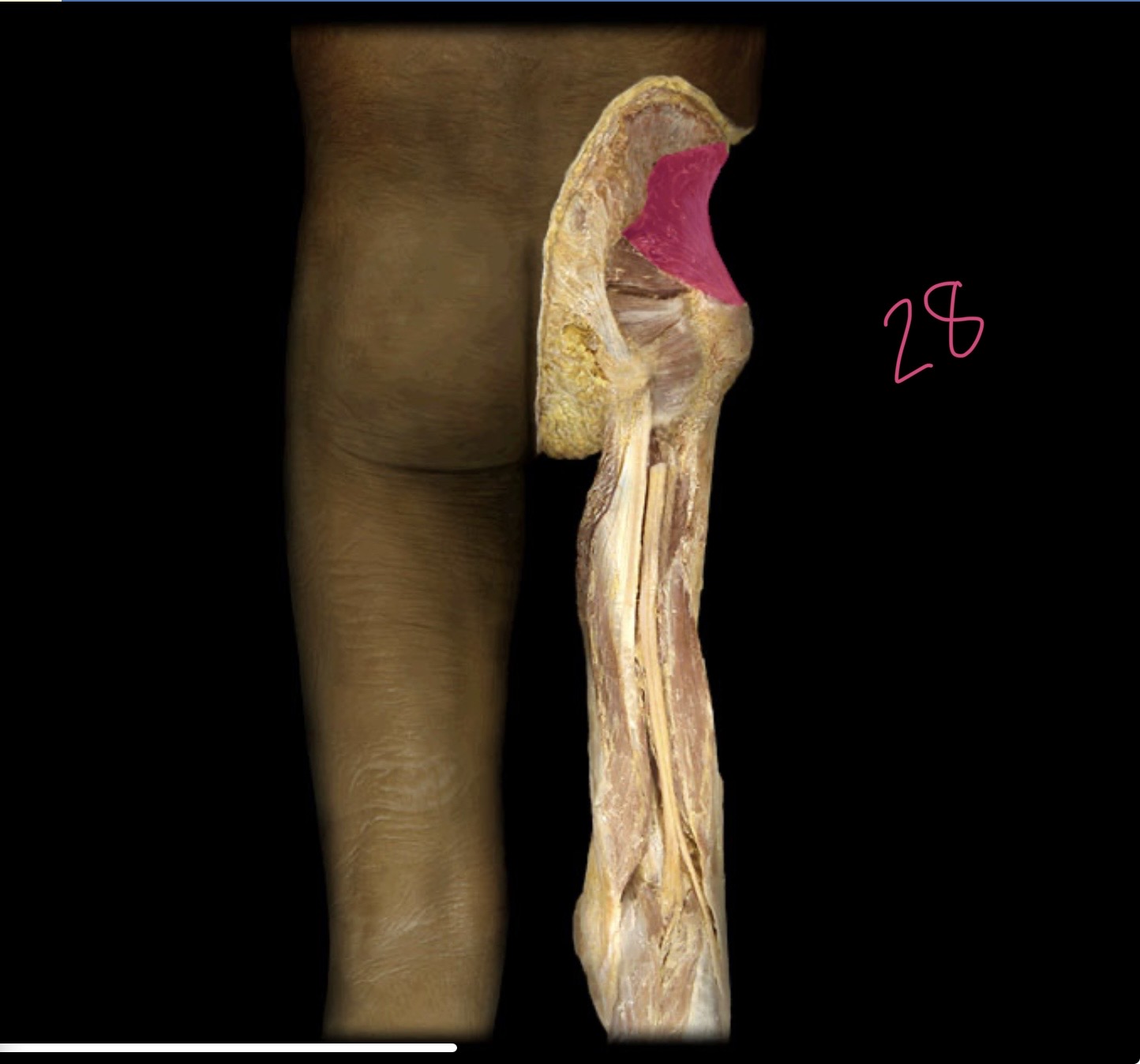 <p>Gluteus minimus</p>