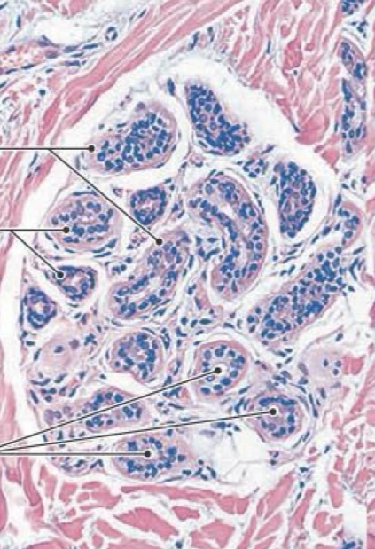 <p>Most numerous type, especially on the palms and soles</p>