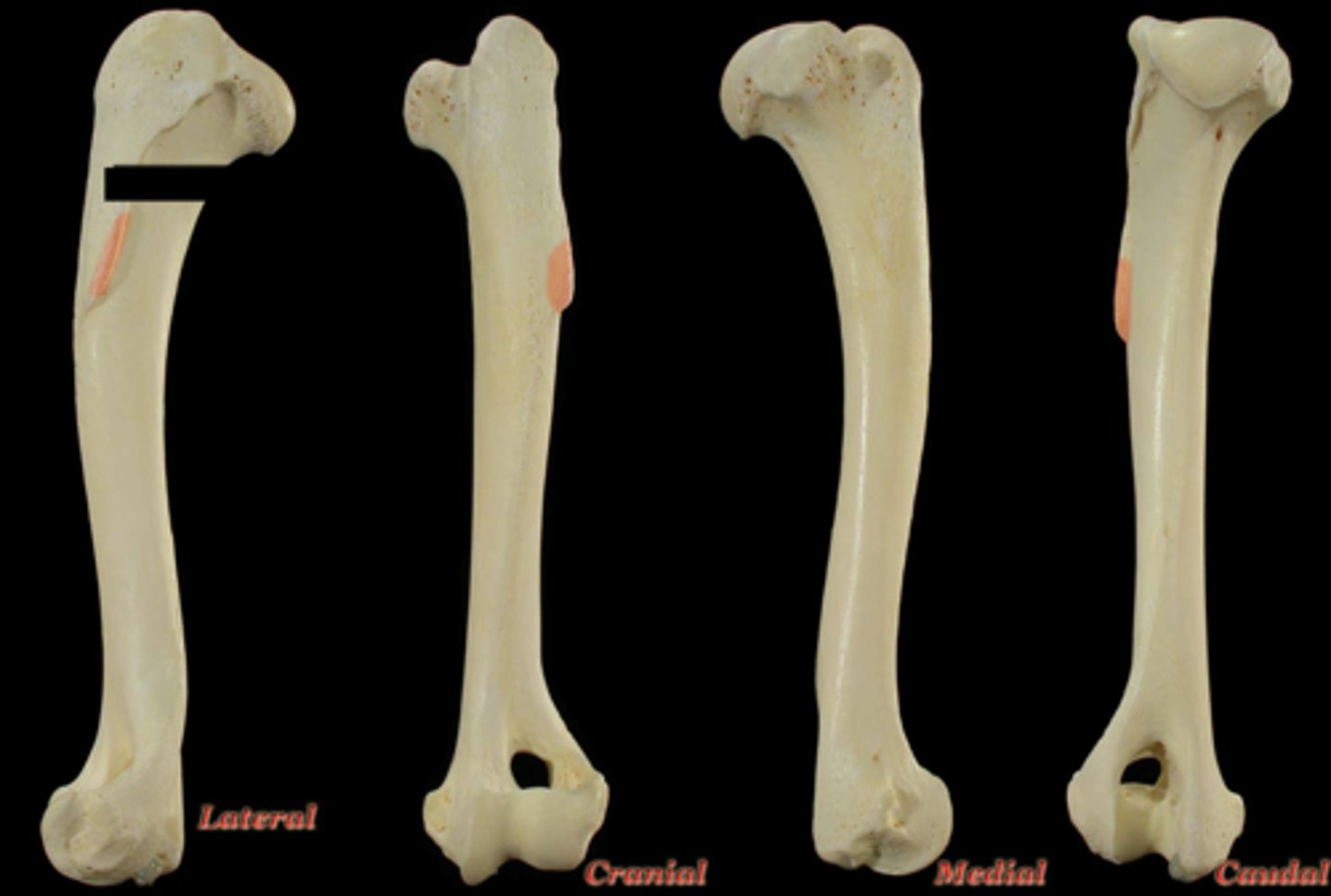 <p>What structure is highlighted in the picture?</p>
