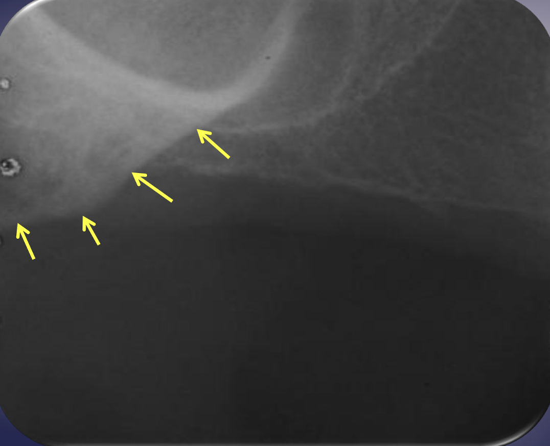 <p>side, site, type of radiograph</p>