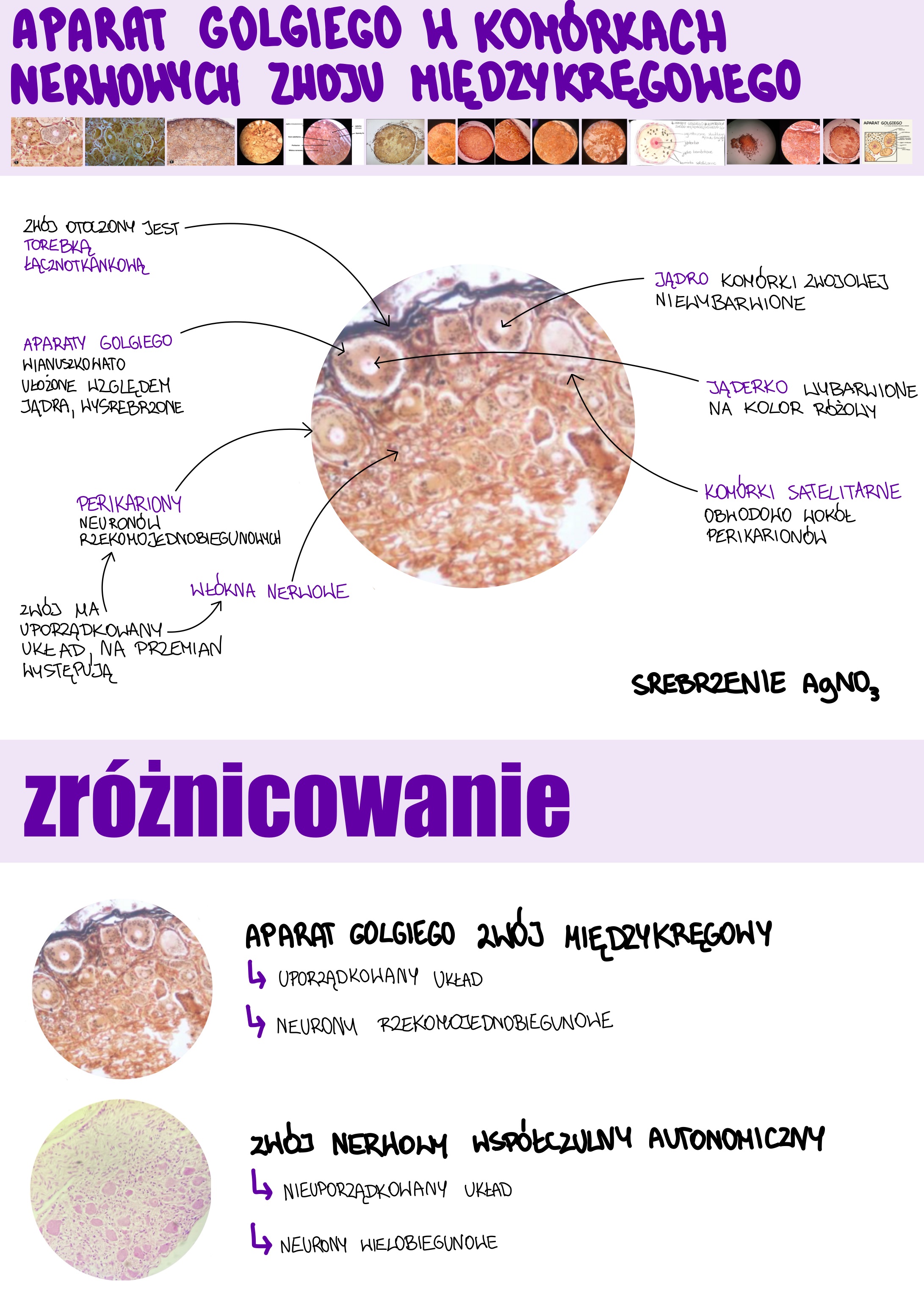 <p>Aparat Golgiego w komórkach nerwowych zwoju międzykręgowego</p>