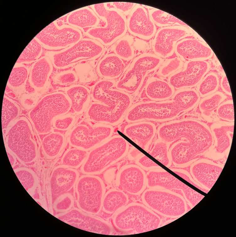 • Located between the seminiferous tubules of the testes.

• Secretes testosterone.