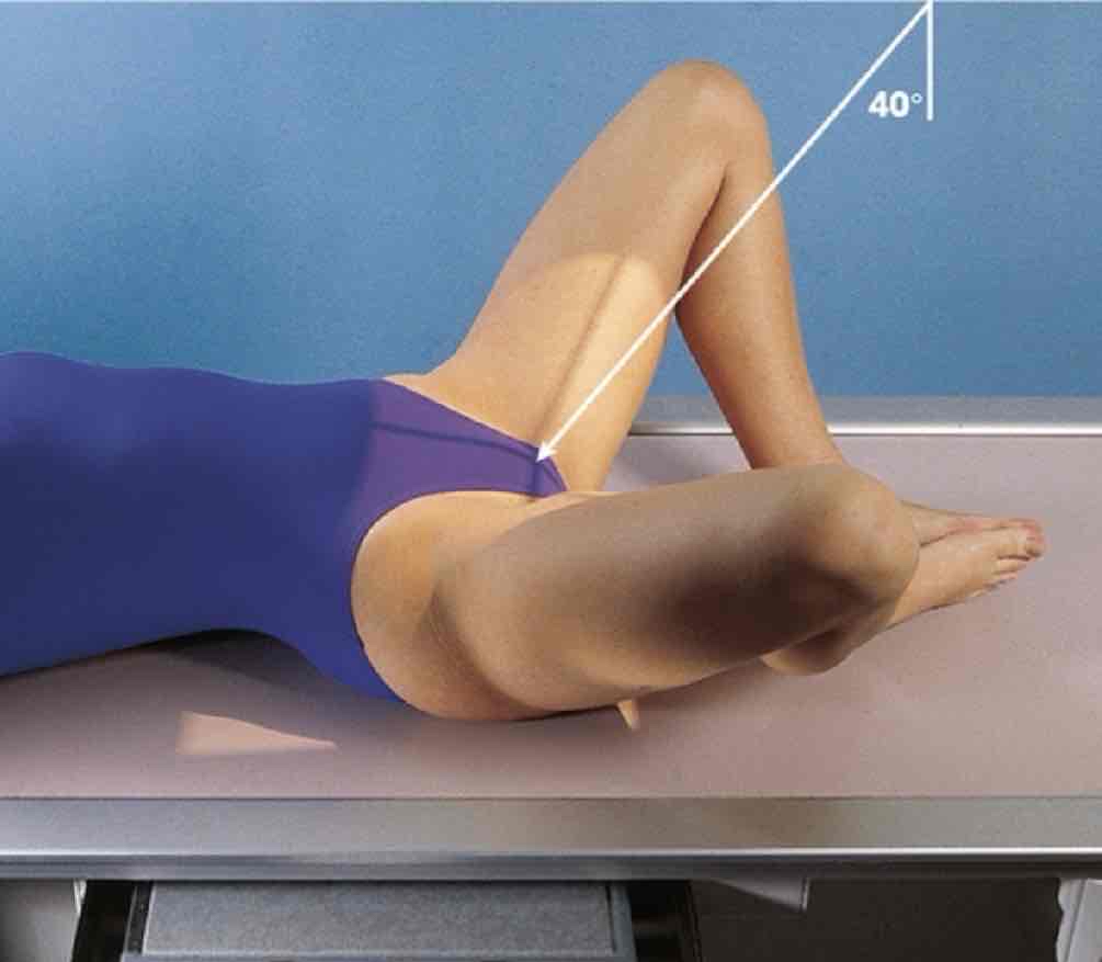 <p>What Projection is this?</p>