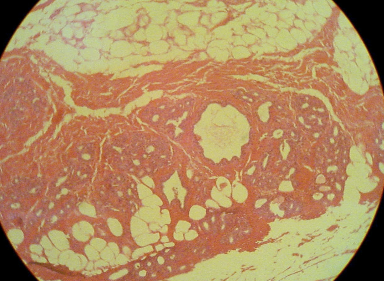 <p>What phase is this mammary tissue undergoing?</p>