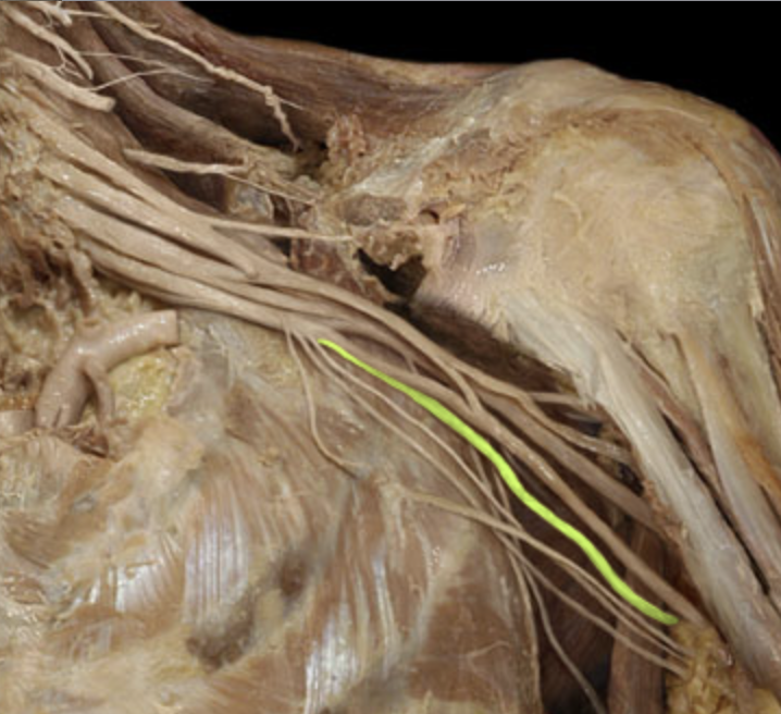 <p><em>table 7, medial cord terminal branch</em><br><span><em>supplies flexor carpi ulnaris, FDP tendons 3 &amp; 4, rest of intrinsic hand mm</em></span></p>