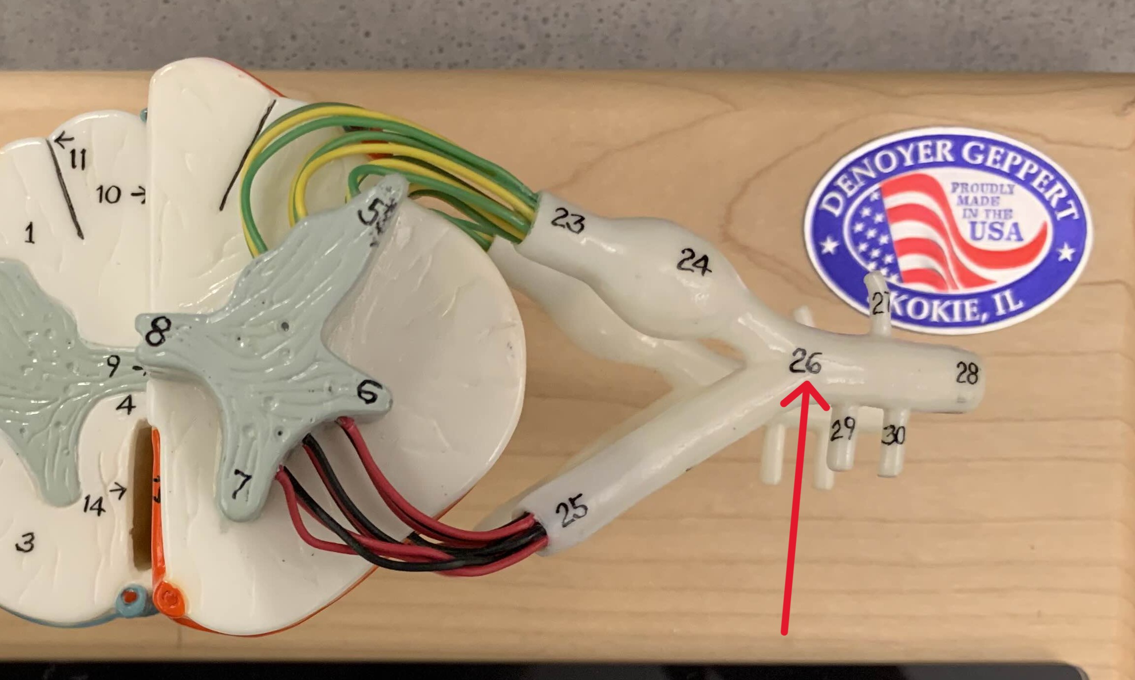 <p>Which part of the spinal cord is:</p><ul><li><p>Where dorsal and ventral roots meet</p></li></ul><p></p>