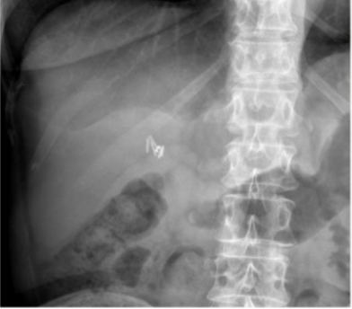 <p>What is this and what type of scan </p>