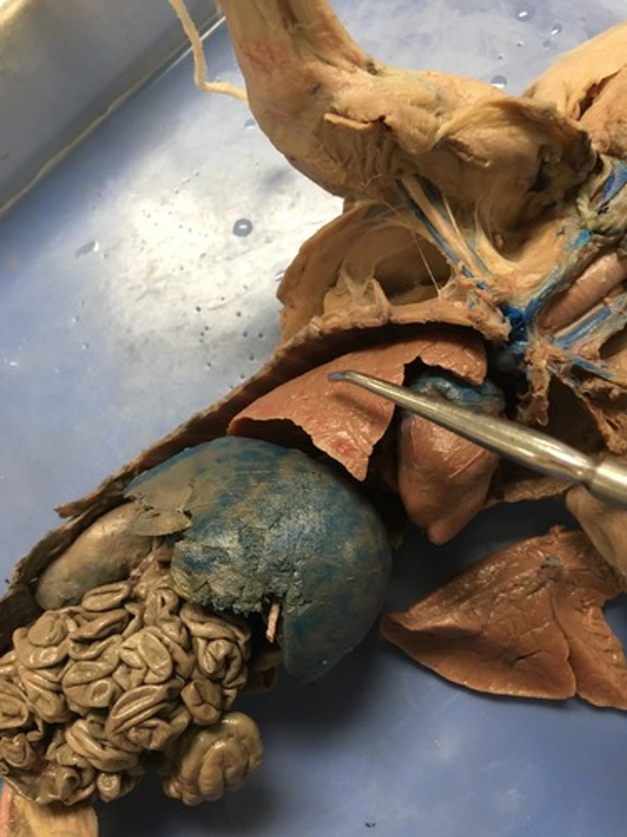 <p>What is the name of this structure? (Tip of forceps)</p>