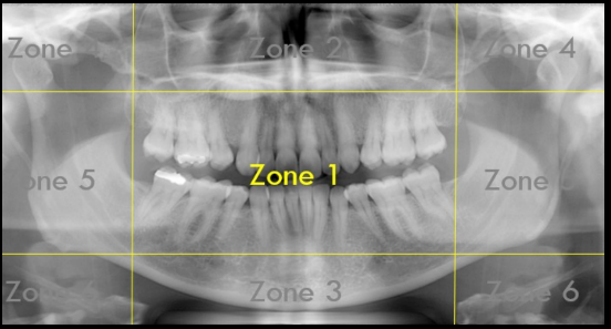 <p>What Zone Is This?</p>