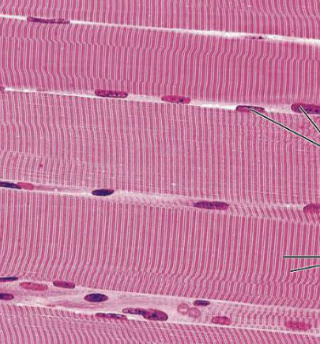 <p>What type of muscle tissue is this?</p>