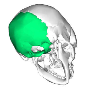 <p>Which cranial bone is this? (1)</p>