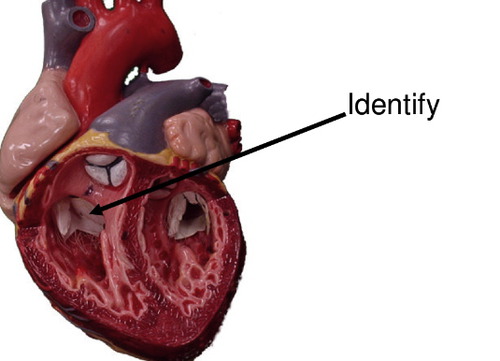 <p>Prevents back-flow of blood into right atrium during ventricular systole; also called the tricuspid valve</p>