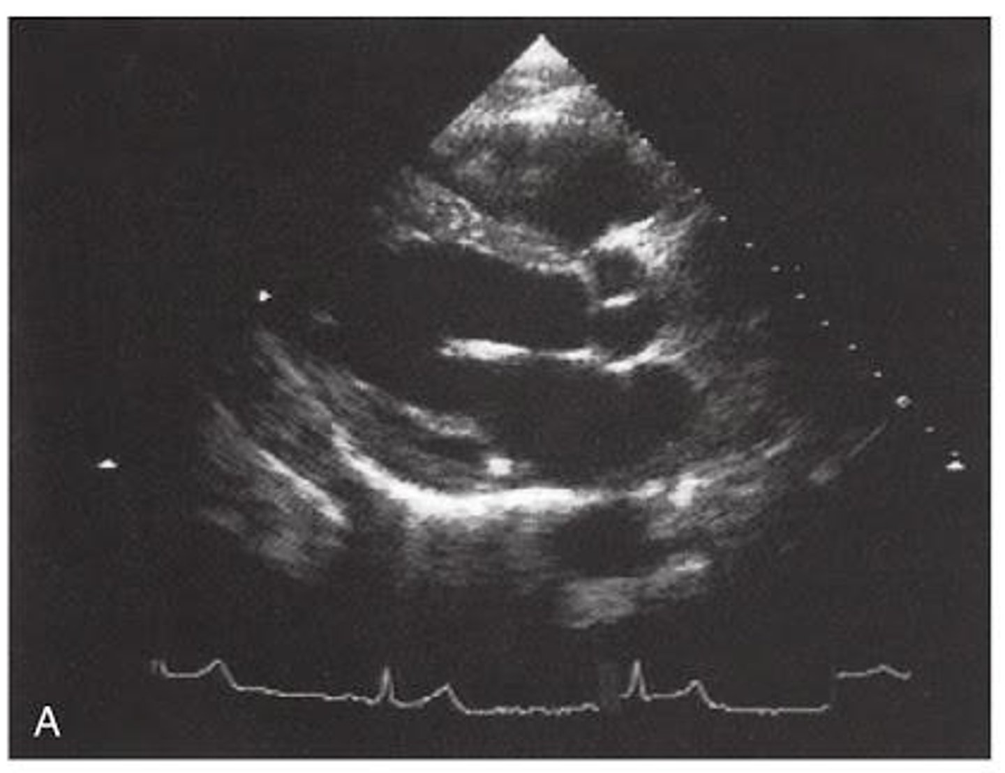 <p>PSLA is used to visualize ____ and _____</p>