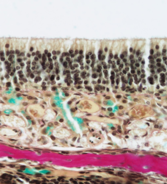 <p>Identify the organ, the type of epithelium, the lamina propria and Boman’s glands.</p>
