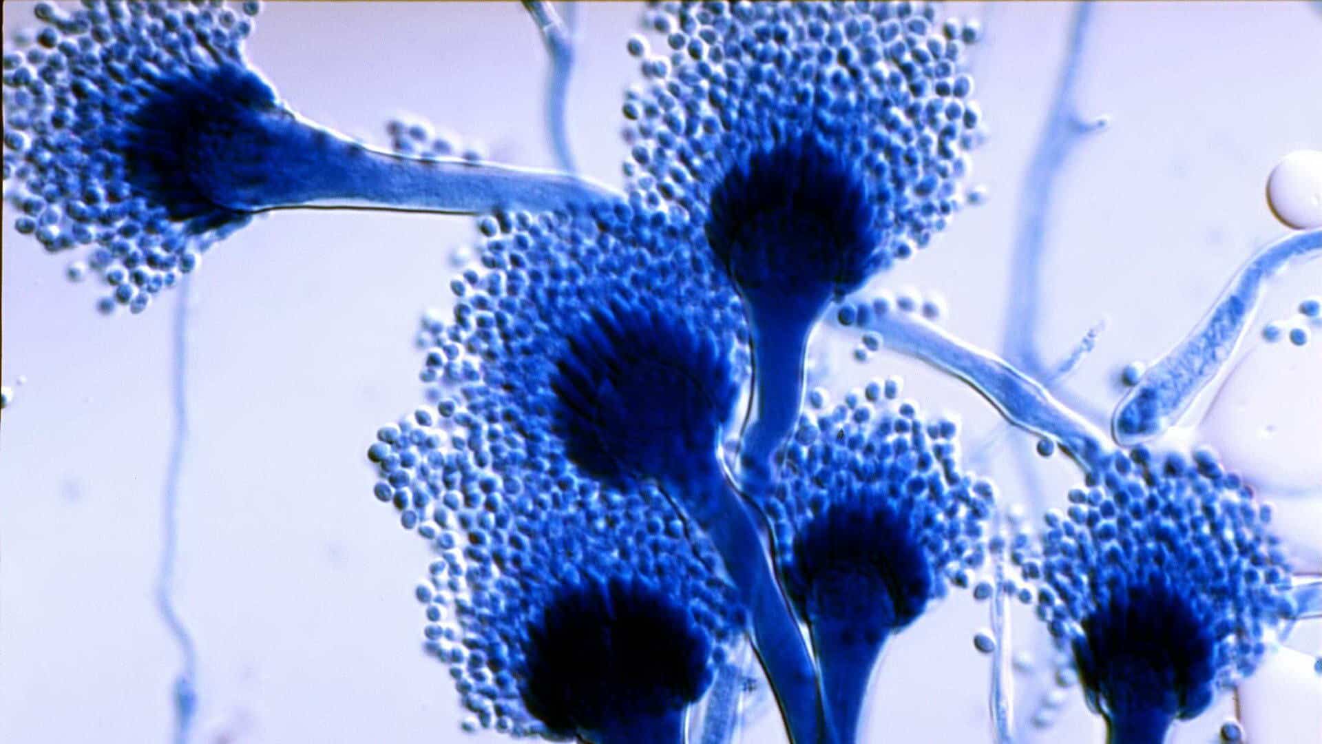 <p>Aspergillosis (cutaneous &amp; respiratory)</p><p>Fungi - ascomycota (septate hyphae), both ascospores (sexual) and conidia (asexual)</p><p>bread mold, respiratory transmission, diagnosed via patient history/culturing</p>