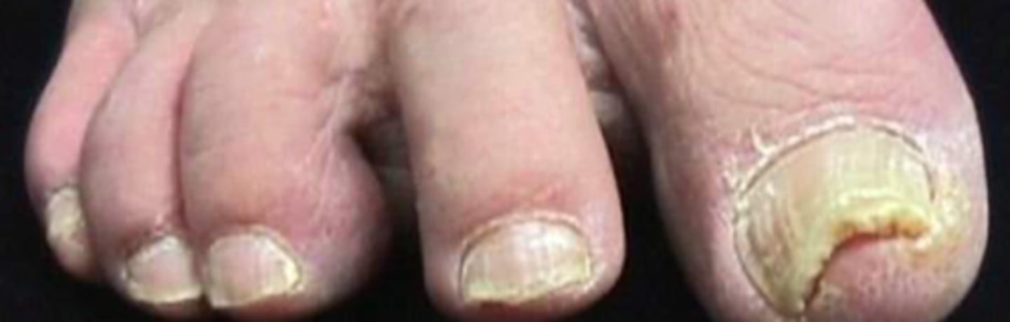 <p>What is the diagnosis?</p>