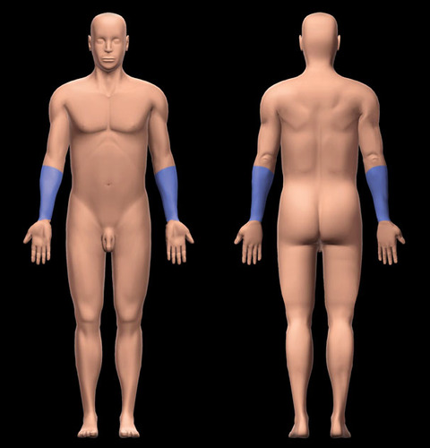 Identify the body region