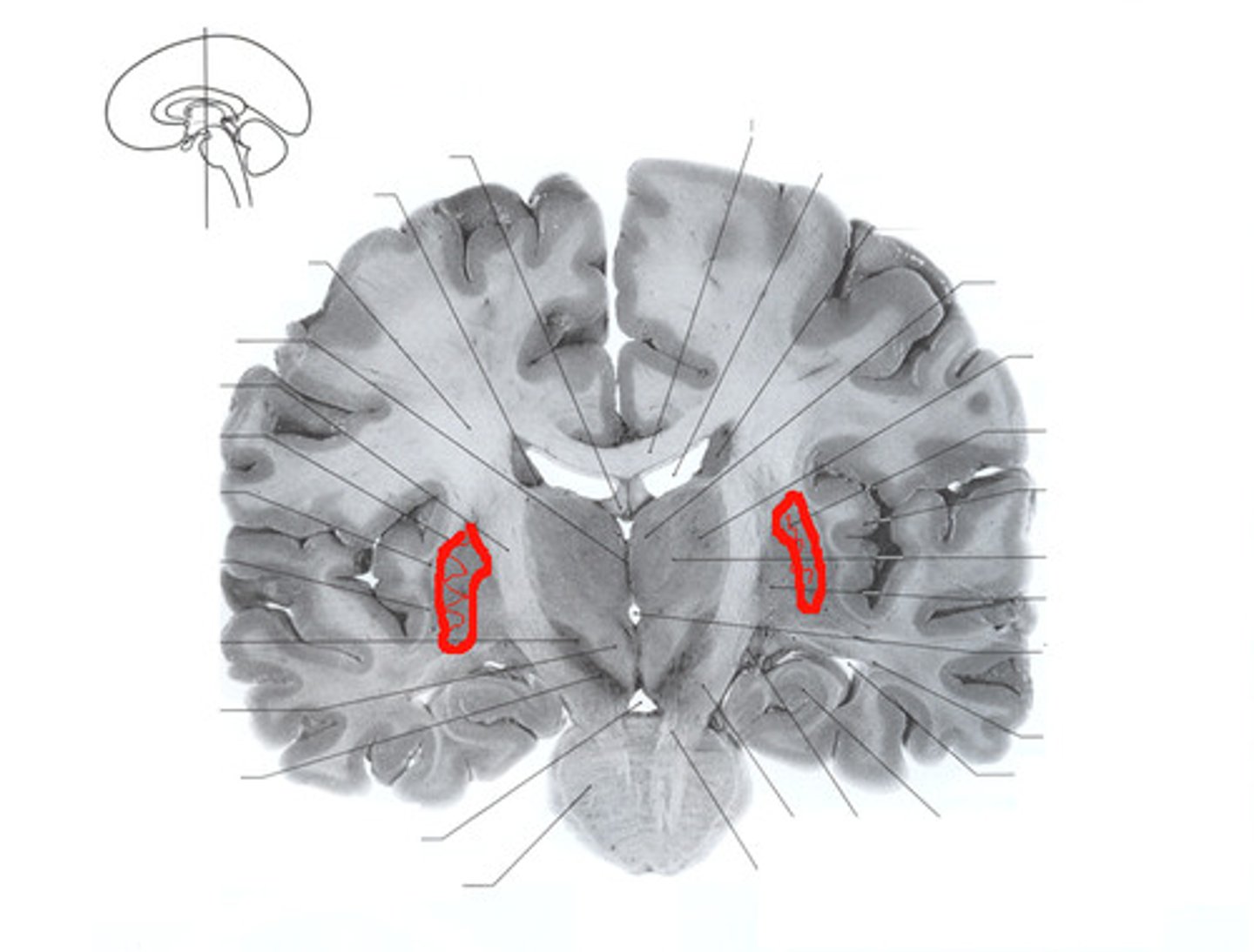 <p>one of the basal ganglia</p>