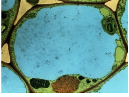 What are Vacuoles