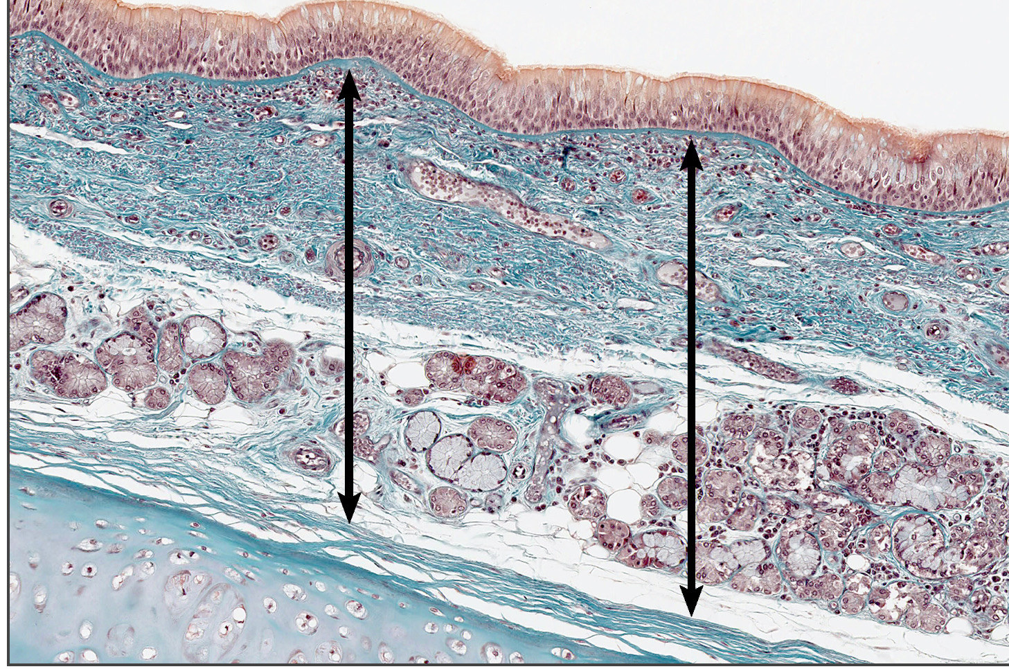 term image