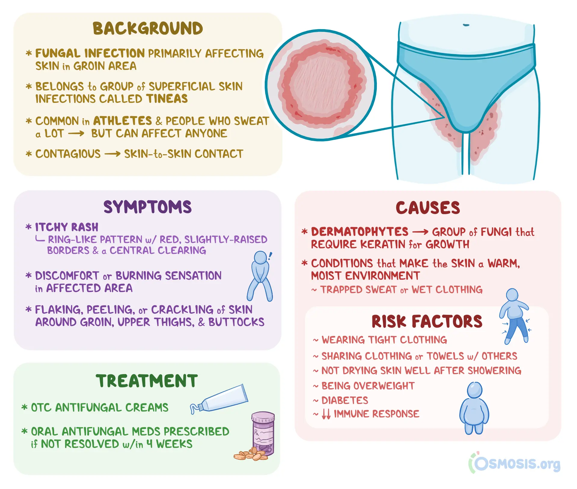<p>PP: fungal infection of groin+gluteal cleft</p><p>E: dermatophytes<br>contaminated towels/sheets<br>autoinnoculation</p><p>CM: scaly plaque with widespread erythema<br>intensely pruritic</p><p>TX:<br>NP: keep groin dry<br>weight loss</p><p>MX: topical azoles x 2-4 weeks</p>