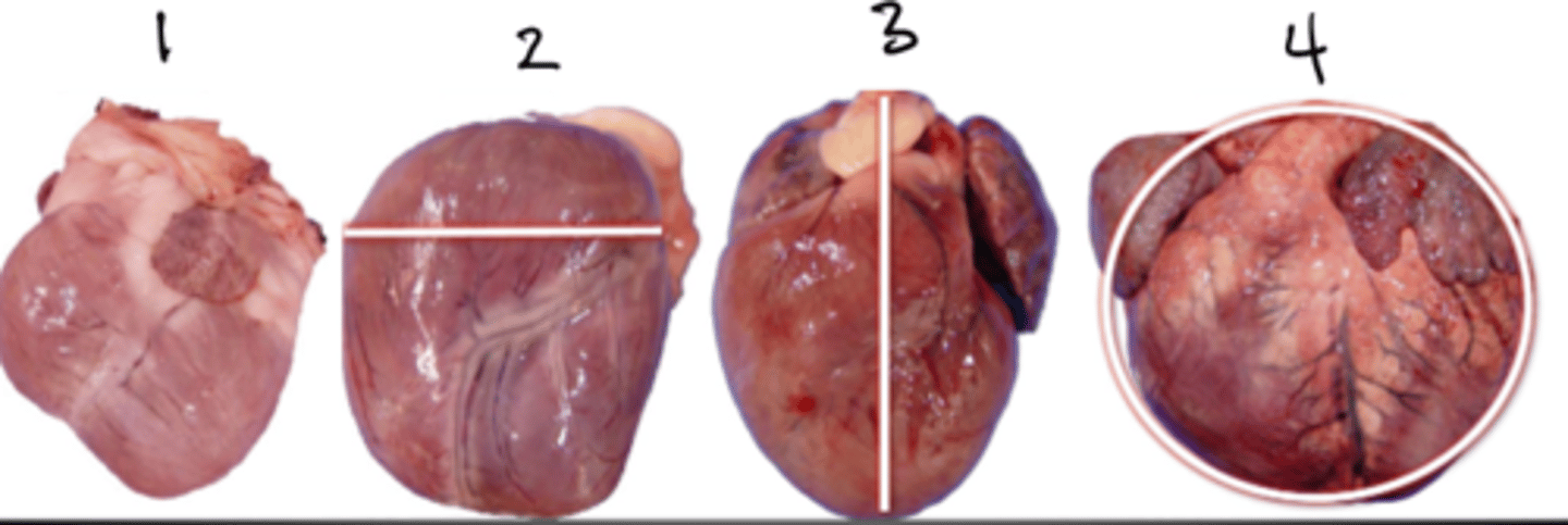 <p>Describe the gross appearance of a heart that has undergone right-side cardiac hypertrophy. Which of the following may lead to right-sided hypertrophy?</p><p>-Pulmonic stenosis</p><p>-Aortic stenosis</p><p>-Mitral valve disease</p><p>-HCM</p><p>-Pulmonary hypertension</p>